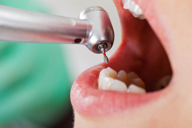 Best Cracked Tooth Emergency Dentist  in Geva, NE